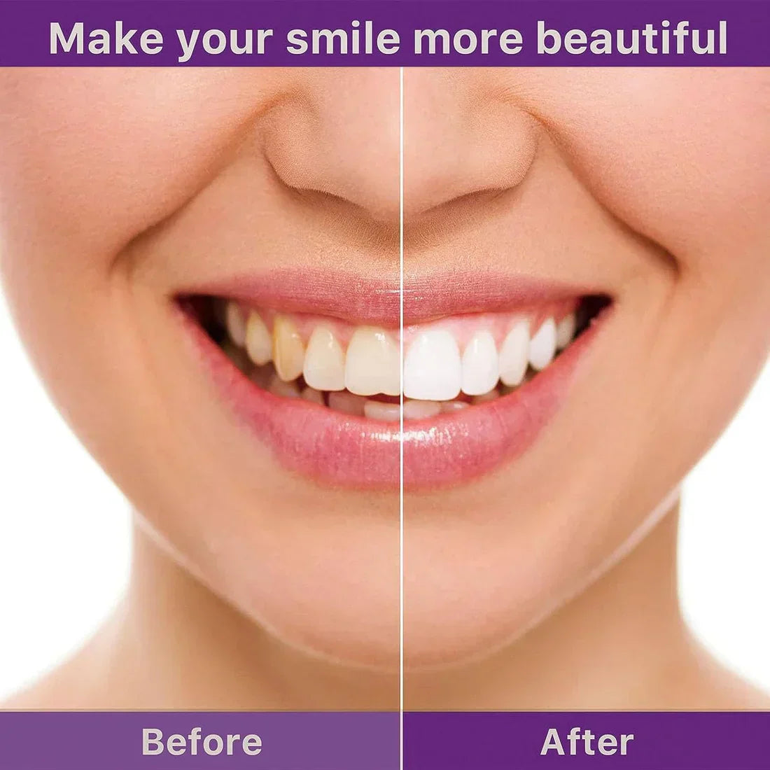 Hismile v34 Serum, Teeth Colour Corrector