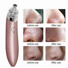 Blackhead Remover