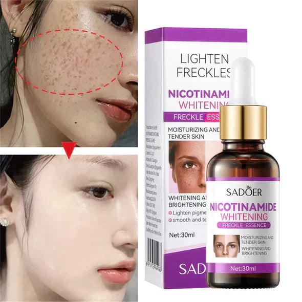 Nicotinamide Whitening Serum Freckle Essence _ (Original)